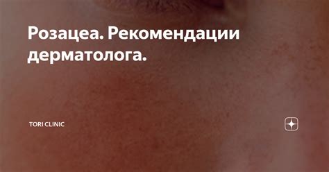 Рекомендации дерматолога