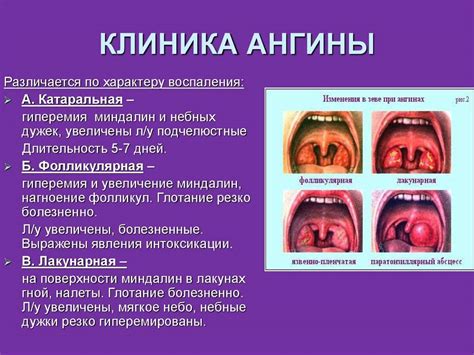 Рекомендации по улучшению состояния горла