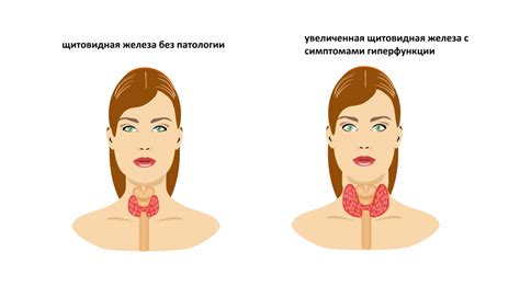 Рекомендации при пониженном ТТГ у женщин