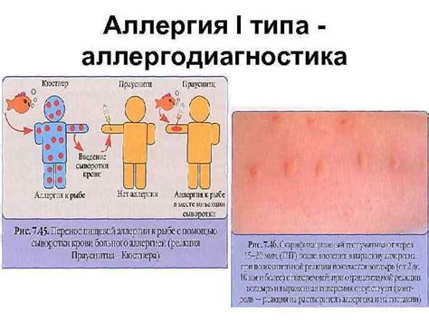 Риск аллергических реакций у малышей