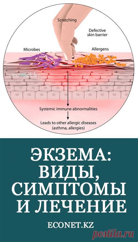 Симптомы, следующие за зудом