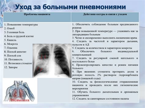 Симптомы воспаления легких