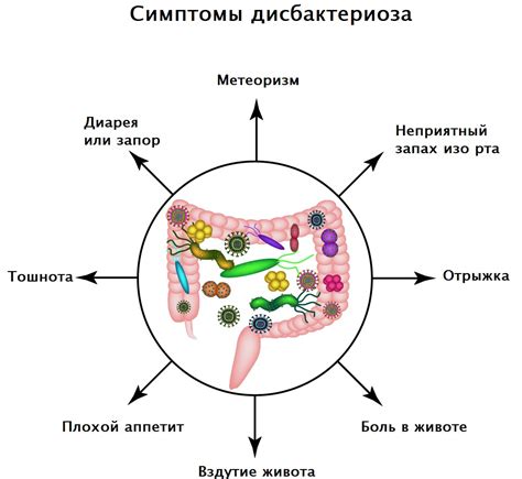 Симптомы дисбактериоза