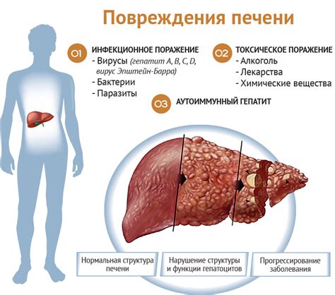 Симптомы зашлакованности печени у женщин