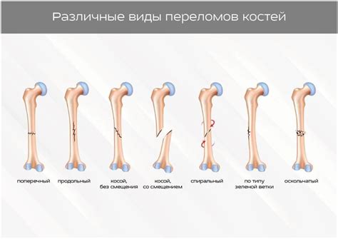 Симптомы и диагностика травмы