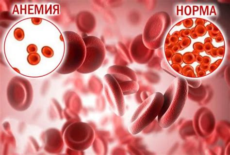 Симптомы и методы лечения воспаления крови у подростков