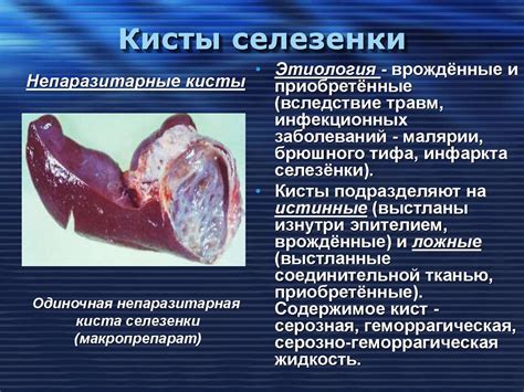 Симптомы и последствия увеличенной селезенки