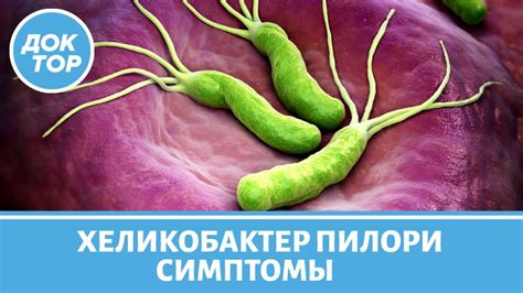 Симптомы наличия хеликобактер пилори в желудке у человека: какие они и как распознать