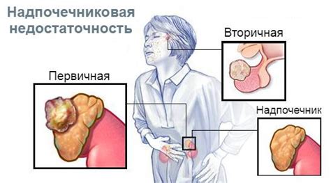 Симптомы недостаточности Bargenia