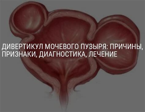 Симптомы полного мочевого пузыря