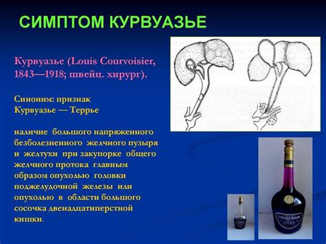 Симптом Краузе как основной симптом при цефалгии