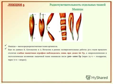 Слабая мышечная тонусность