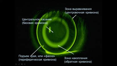 Современные технологии линз