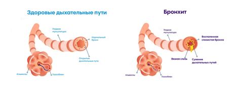 Способы борьбы с заболеванием