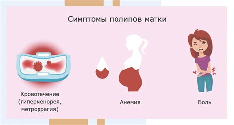 Способы лечения полипа