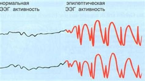 Статичность и нормальная активность