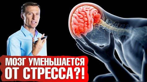 Стресс как механизм защиты организма