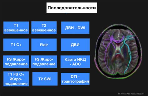 Типичные примеры МР