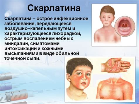 Токсокары у детей: как возникает проблема