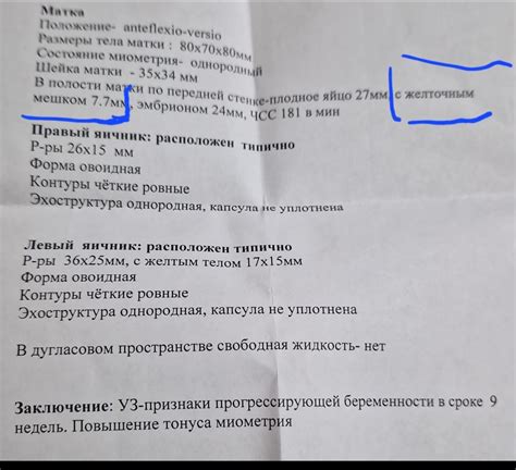 Увеличение функциональности мешка