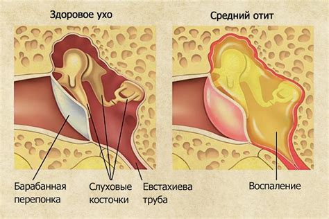 Ухо булькает при глотании - насколько это опасно?