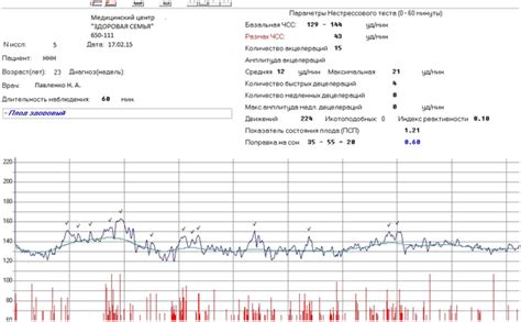 Факторы, влияющие на результаты КТГ