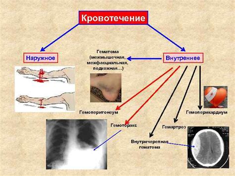 Факторы, спровоцировавшие кровотечение: