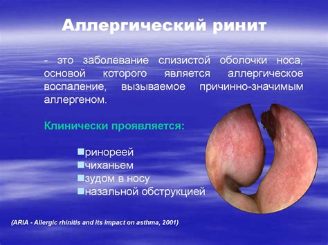 Физиологические дефекты