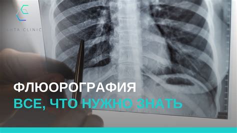 Флюорография: что нужно знать