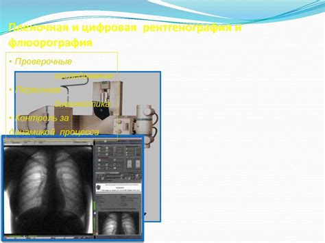 Цифровая флюорография: основы и принципы