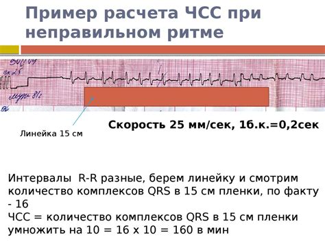 Частота сердечных сокращений и ее изменения