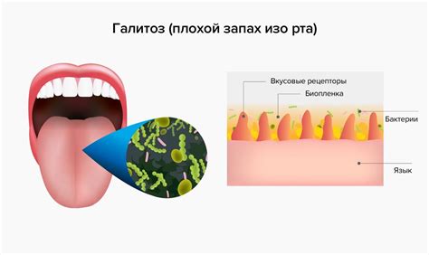 Черви изо рта в соннике