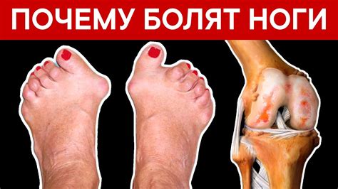 Что может вызывать проблемы с лапками