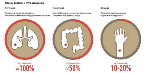 Что такое Сибирская язва?