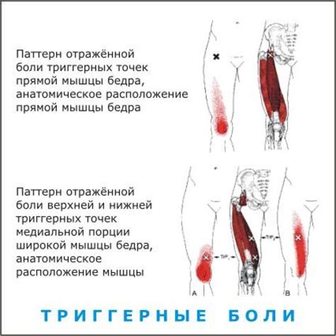 Что такое боли в ягодицах