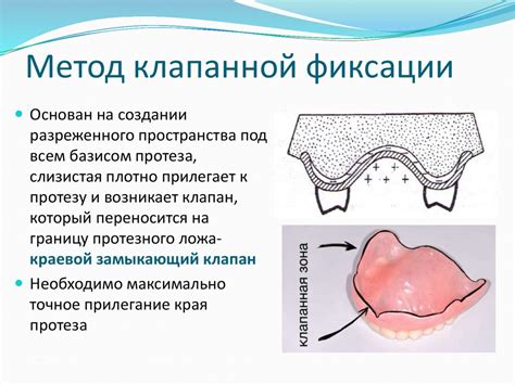 Шаг 3: Быстрый метод фиксации