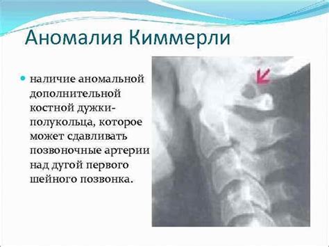 Эффективное лечение зыбучей аномалии ошейника