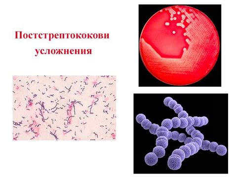 Эффективные методы профилактики бета гемолитического стрептококка