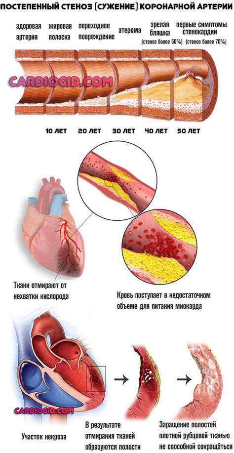  Нарушение кислородного обмена 